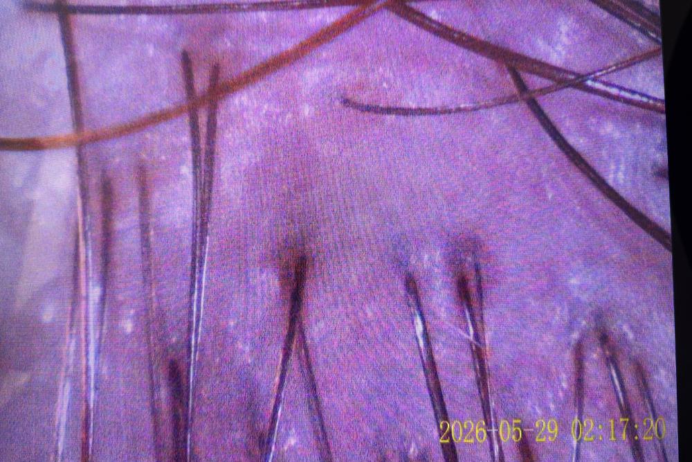 unnamed image